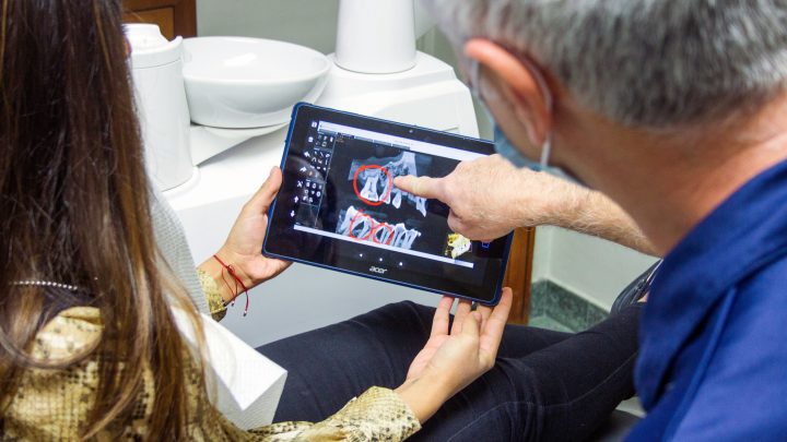 Jak wyleczyć próchnicę bez dentysty?